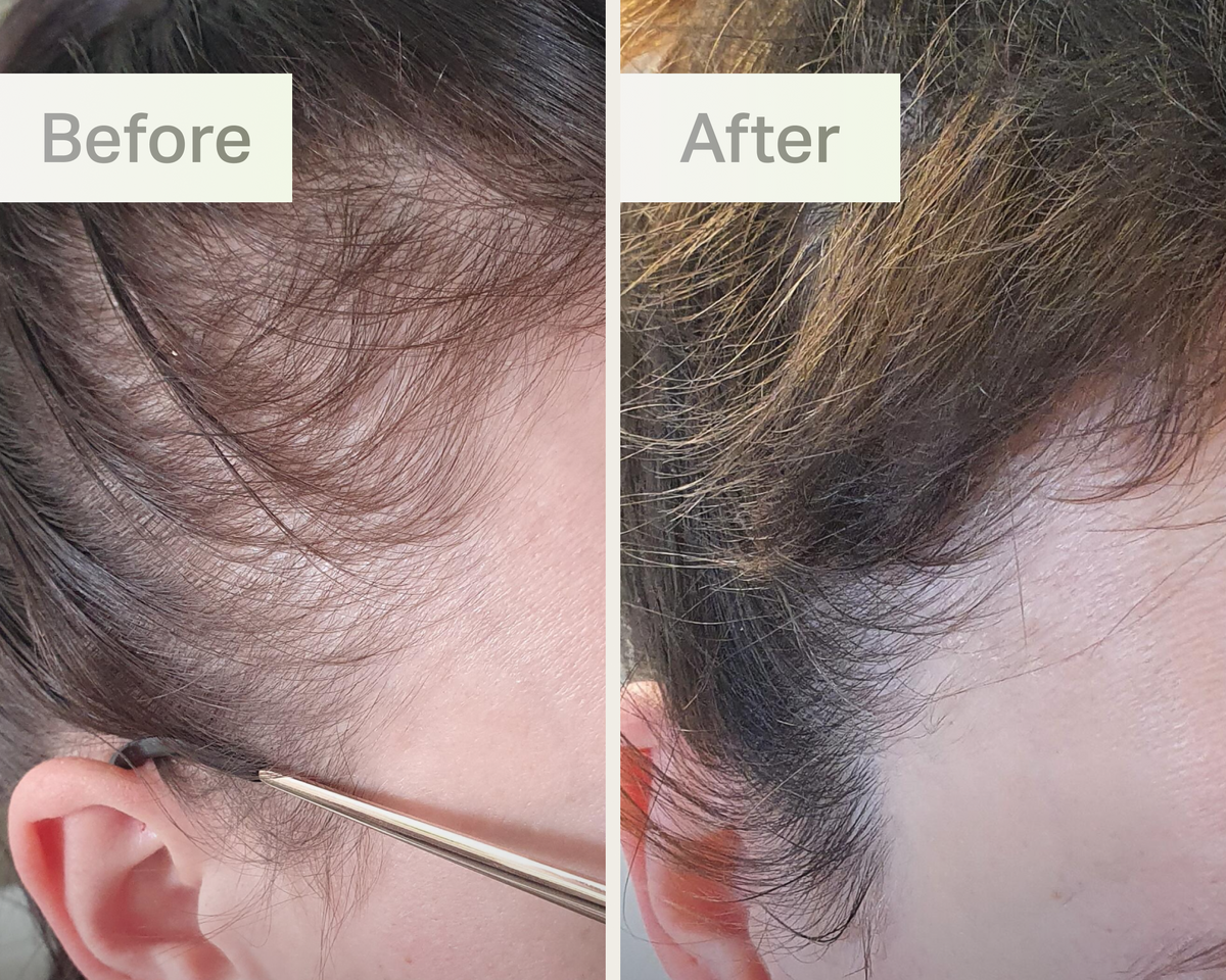 customer before and after image.