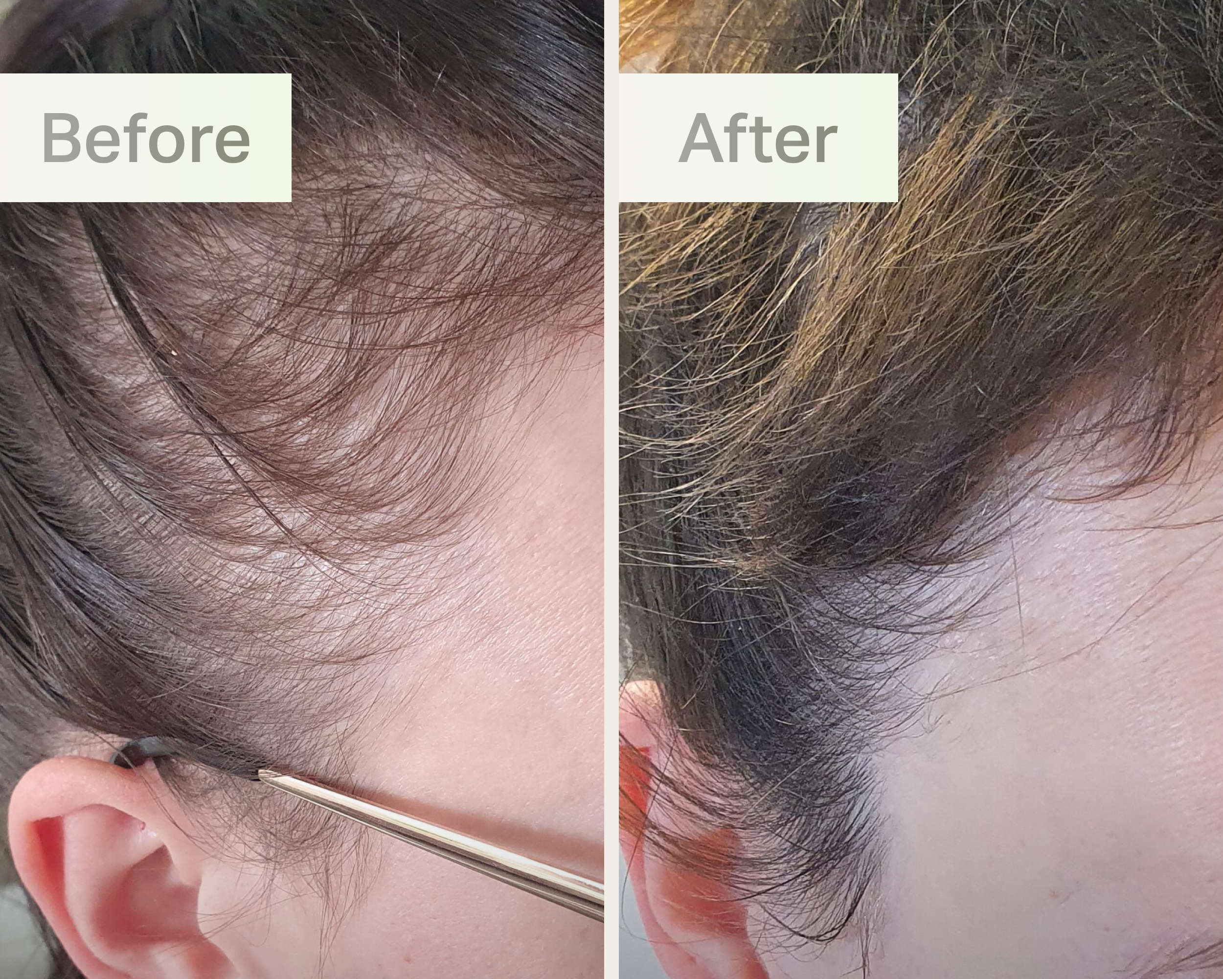 customer before and after image.