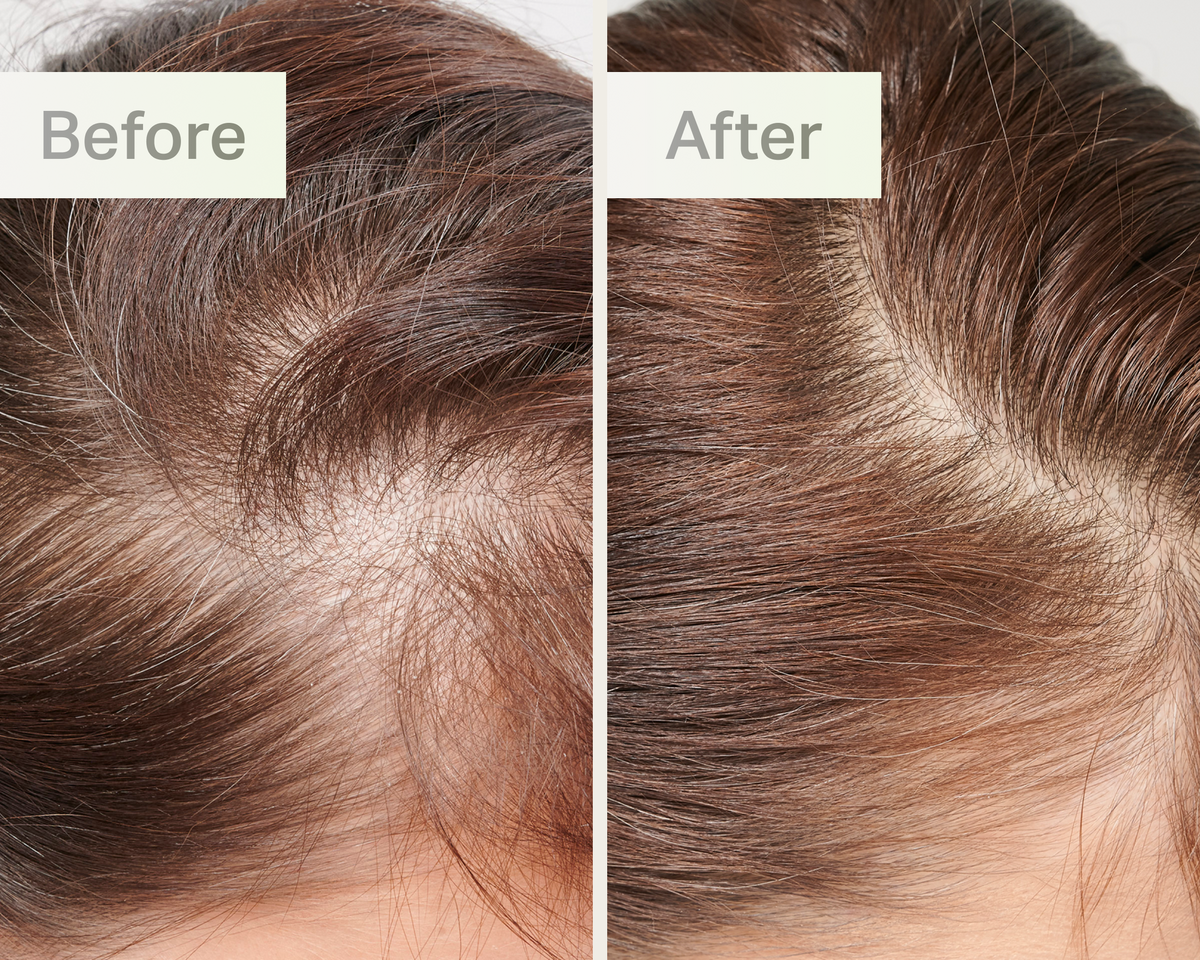 customer before and after image.