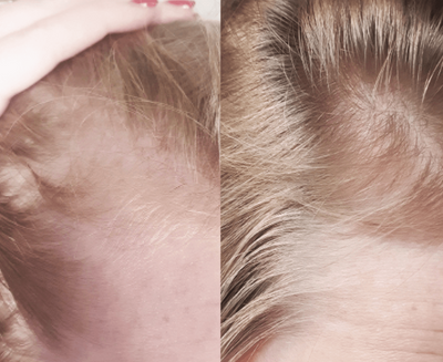 customer before and after image.