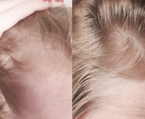 customer before and after image.
